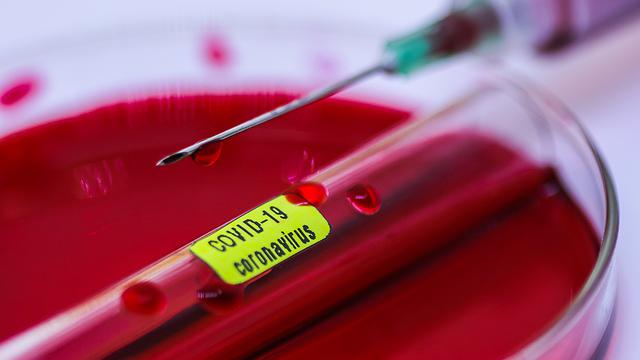 GDF declara emergência por risco de “pandemia” de coronavírus