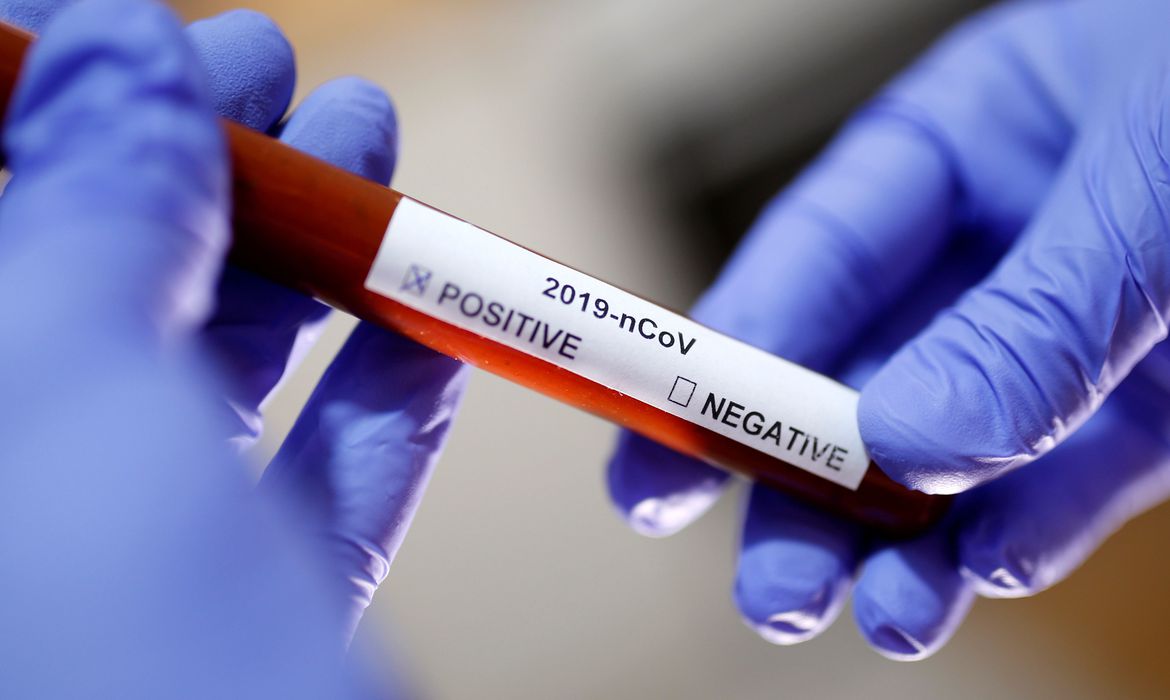 URGENTE: OMS considera ameaça internacional do coronavírus ‘muito elevada’