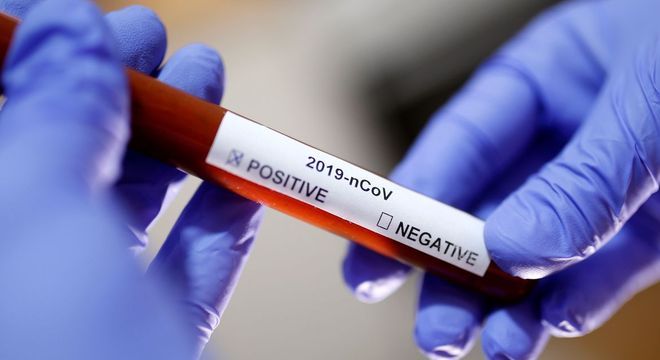 Ministério da Saúde confirma primeiro caso de coronavírus no DF