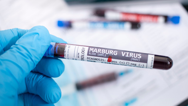 OMS publica informe sobre risco de espalhamento do vírus de Marburg